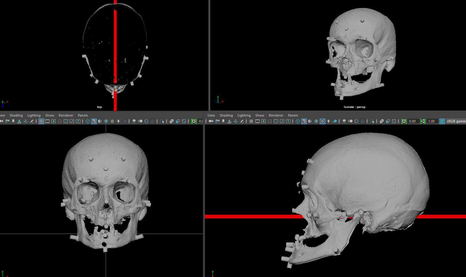 reconstruction image